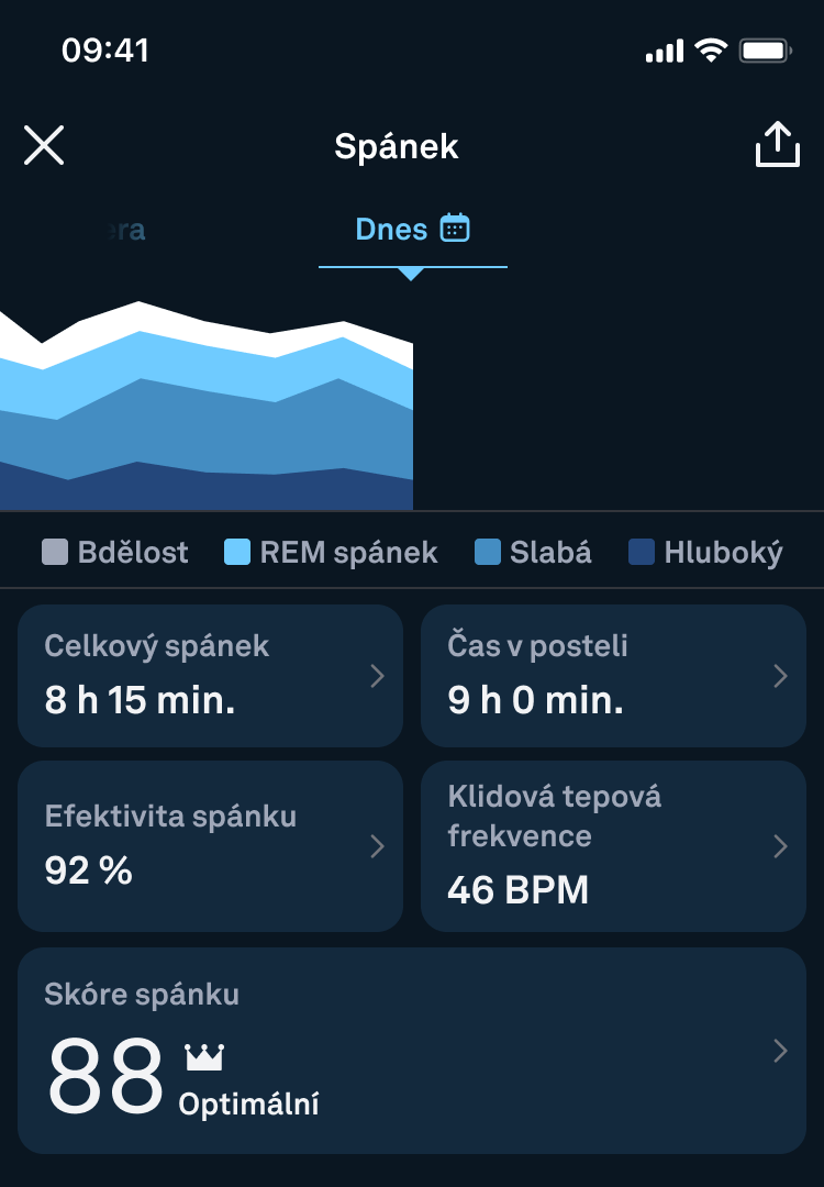 Sleep_Stages_Detailed_View_1_cs.png