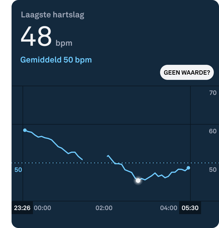 Troubleshooting_Gaps_in_Heart_Rate_Graphs_nl.png