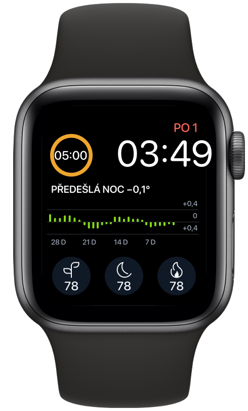 How_to_Use_Ouras_Apple_Watch_Complications_3_cs.png